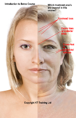 botox warszawa