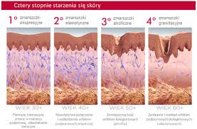 mezoterapia kolagenowa warszawa